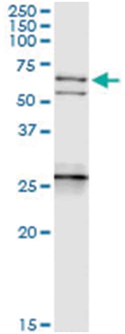 Abnova anti-NEFL, Human, IP-WB Antibody Pair, Abnova™