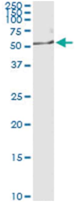 NEK2, Human, IP-WB Antibody Pair (PW2), Abnova 1 Set:Antibodies, Monoclonal/Polyclonal
