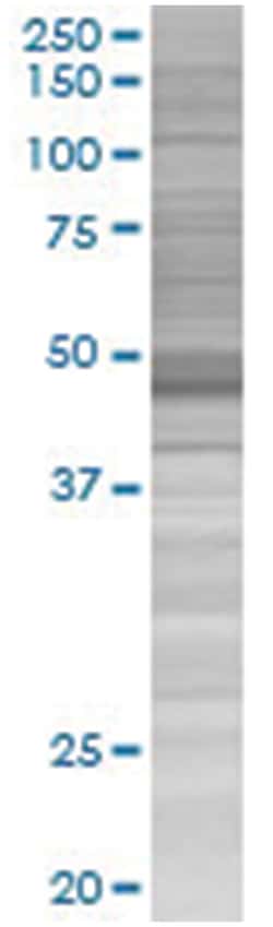 NEK2 293T Cell Overexpression Lysate (Denatured), Abnova 100 &mu;L | Buy Online | Abnova | Fisher Scientific