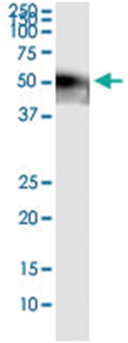 anti-NEUROD2, Human, IP-WB Antibody Pair, Abnova™
