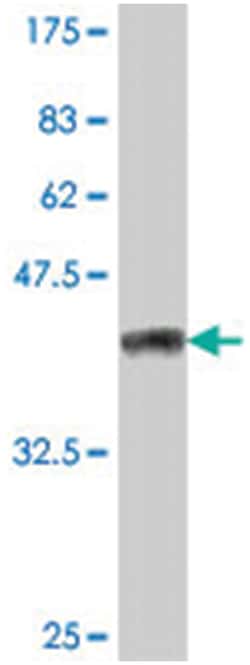 nuclear factor of activated T-cells, cytoplasmic, calcineurin-dependent