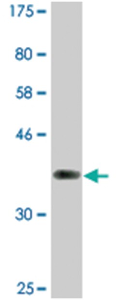 NFATC2, Mouse, Clone: 2A4, Abnova 200 &mu;L | Buy Online | Abnova Corporation | Fisher Scientific