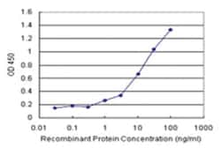 anti-NFKBIB Matched Antibody Pair, Abnova