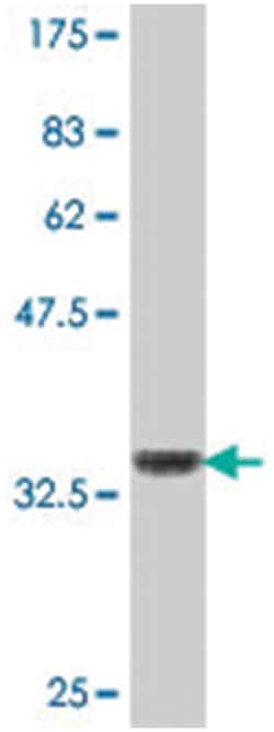 NFKBIE, Mouse, Polyclonal Antibody, Abnova 50&mu;L; Unlabeled:Antibodies,