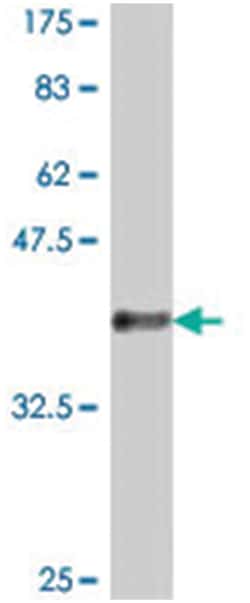 NFKBIL2, Mouse, Polyclonal Antibody, Abnova 50&mu;L; Unlabeled:Antibodies,