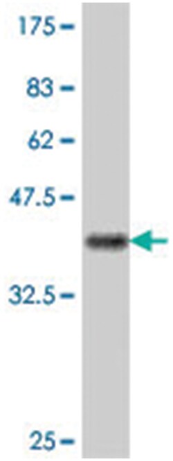 NFRKB, Mouse, Polyclonal Antibody, Abnova 50&mu;L; Unlabeled:Antibodies,