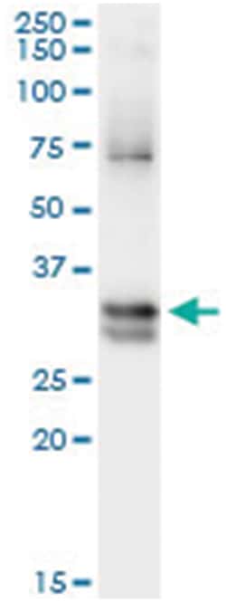 anti-NIT1, Human, IP-WB Antibody Pair, Abnova™