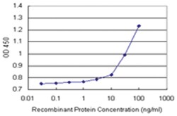 anti-NME1 Matched Antibody Pair, Abnova