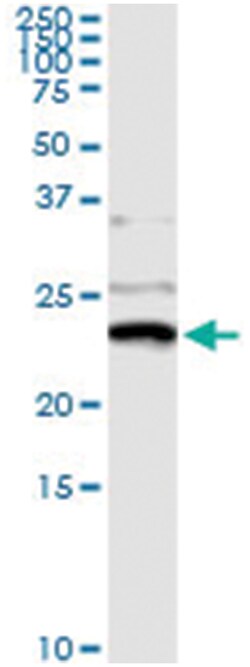 anti-NME1, Human, IP-WB Antibody Pair, Abnova™