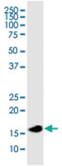 anti-NME2, Human, IP-WB Antibody Pair, Abnova&trade;