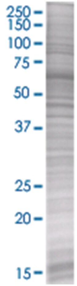 NME3 293T Cell Overexpression Lysate (Denatured), Abnova 100 &mu;L | Buy Online | Abnova | Fisher Scientific