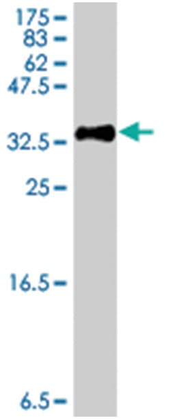 NODAL, Mouse, Polyclonal Antibody, Abnova 50&mu;L; Unlabeled:Antibodies,