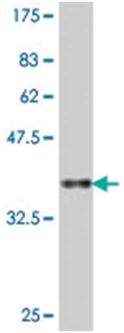 CNOT2, Mouse, Polyclonal Antibody, Abnova 50 &mu;L | Buy Online | Abnova Corporation | Fisher Scientific