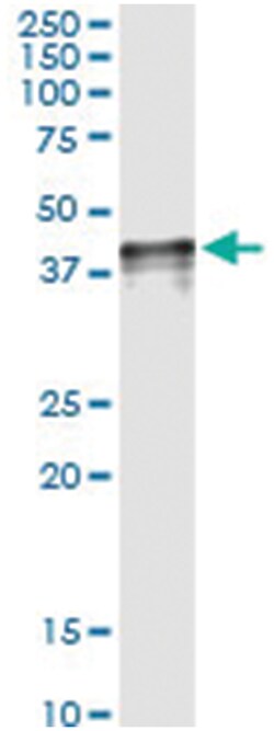 NOV, Human, IP-WB Antibody Pair (PW2), Abnova™