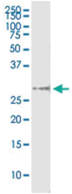 NOV, Human, IP-WB Antibody Pair (PW3), Abnova 1 Set:Antibodies, Monoclonal/Polyclonal