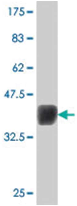NOVA1, Mouse, Polyclonal Antibody, Abnova 50 &mu;L | Buy Online | Abnova Corporation | Fisher Scientific