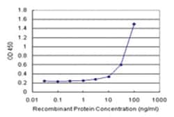 anti-NOVA1 Matched Antibody Pair, Abnova