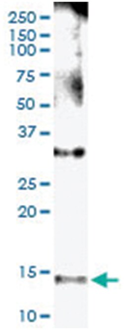 anti-NPHP1, Human, IP-WB Antibody Pair, Abnova&trade;