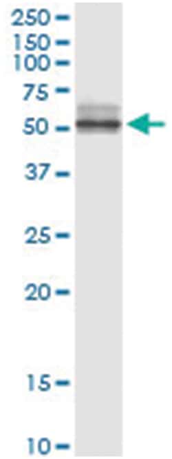 anti-NPTX2, Human, IP-WB Antibody Pair, Abnova™