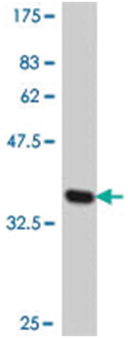 YBX1, Mouse, Polyclonal Antibody, Abnova 50&mu;L; Unlabeled:Antibodies,