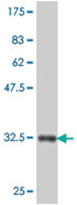 discoidin domain receptor tyrosine kinase 2, Mouse, Polyclonal Antibody,