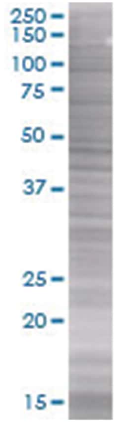 NTS 293T Cell Overexpression Lysate (Denatured), Abnova 100 &mu;L | Buy Online | Abnova | Fisher Scientific