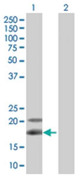 NTS 293T Cell Overexpression Lysate (Denatured), Abnova 100 &mu;L | Buy Online | Abnova | Fisher Scientific