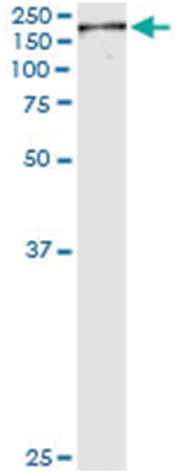 anti-NUMA1, Human, IP-WB Antibody Pair, Abnova 1 Set:Antibodies, Monoclonal/Polyclonal