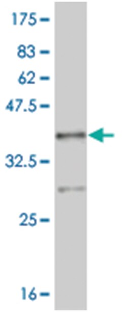 NR4A2, Mouse, Clone: 1D9, Abnova 100&mu;g; Unlabeled:Antibodies, Monoclonal