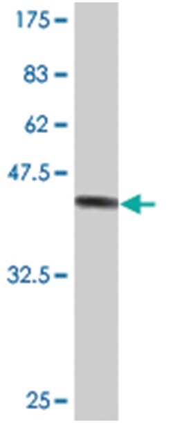 NR4A2, Mouse, Clone: 2C12, Abnova 100 &mu;g | Buy Online | Abnova | Fisher Scientific