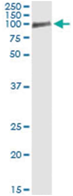 OCLN, Human, IP-WB Antibody Pair (PW1), Abnova™