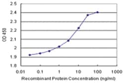 anti-ODC1 Matched Antibody Pair, Abnova 1 Set:Antibodies, Monoclonal/Polyclonal