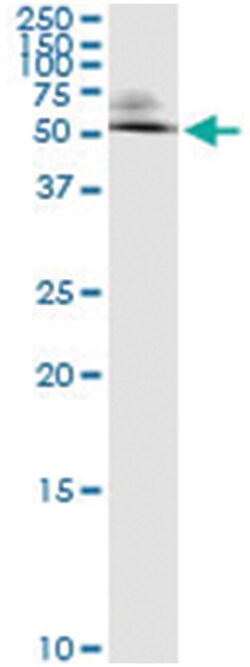 anti-ODC1, Human, IP-WB Antibody Pair, Abnova&trade;