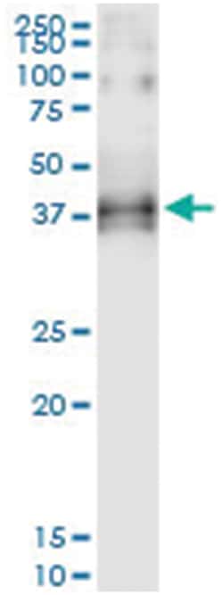 anti-OGN, Human, IP-WB Antibody Pair, Abnova&trade;