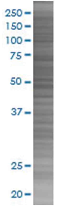 OMP 293T Cell Overexpression Lysate (Denatured), Abnova