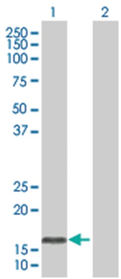 OMP 293T Cell Overexpression Lysate (Denatured), Abnova 100 &mu;L | Buy Online | Abnova | Fisher Scientific