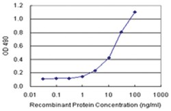 anti-ORM1 Matched Antibody Pair, Abnova 1 Set:Antibodies, Monoclonal/Polyclonal