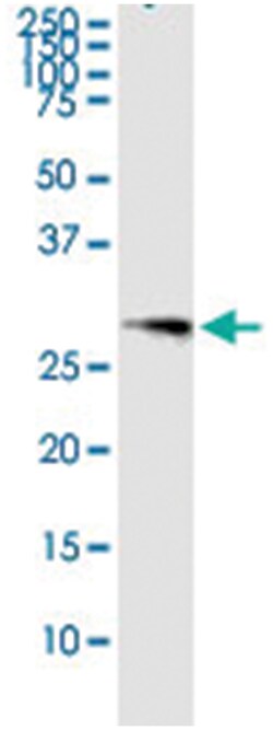 anti-OSM, Human, IP-WB Antibody Pair, Abnova™