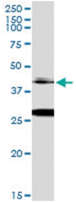 anti-OTX1, Human, IP-WB Antibody Pair, Abnova™