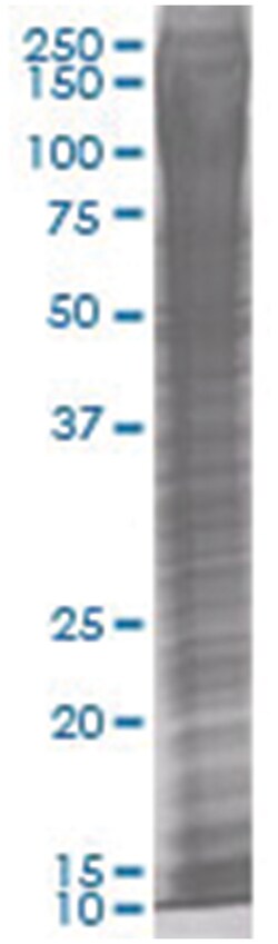 OVOL1 293T Cell Overexpression Lysate 1 (Denatured), Abnova 100 &mu;L | Buy Online | Abnova | Fisher Scientific