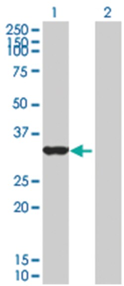 OVOL1 293T Cell Overexpression Lysate 1 (Denatured), Abnova 100 &mu;L | Buy Online | Abnova | Fisher Scientific
