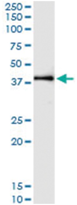 anti-OXA1L, Human, IP-WB Antibody Pair, Abnova&trade;