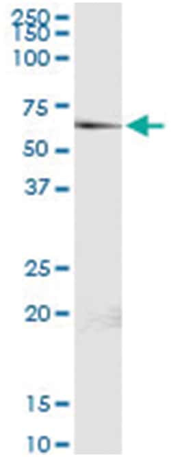 anti-P4HB, Human, IP-WB Antibody Pair, Abnova™