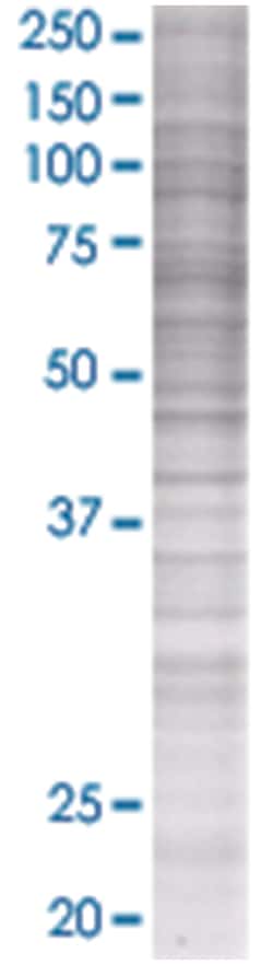 PAEP 293T Cell Overexpression Lysate (Denatured), Abnova 100 &mu;L | Buy Online | Abnova | Fisher Scientific