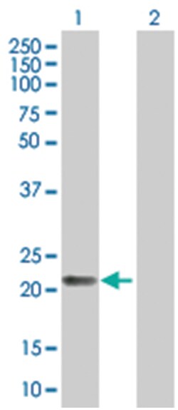 PAEP 293T Cell Overexpression Lysate (Denatured), Abnova 100 &mu;L | Buy Online | Abnova | Fisher Scientific