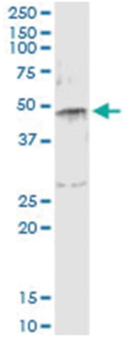 SERPINE1, Human, IP-WB Antibody Pair (PW2), Abnova&trade;