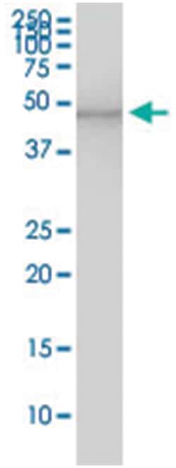 SERPINE1, Human, IP-WB Antibody Pair (PW3), Abnova™