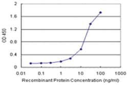 anti-SERPINB2 Matched Antibody Pair, Abnova