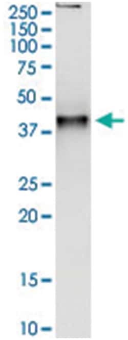 anti-PARK2, Human, IP-WB Antibody Pair, Abnova 1 Set:Antibodies, Monoclonal/Polyclonal