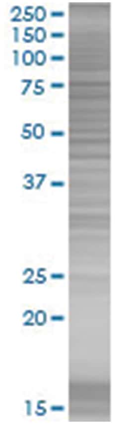 PARN 293T Cell Overexpression Lysate (Denatured), Abnova 100 &mu;L | Buy Online | Abnova | Fisher Scientific
